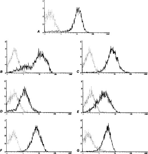 Fig. 2. c-kit Expression on human sarcoma cell lines analyzed by flow cytometry. Control MoAb (┈) and anti CD117-PE (—). (A) M07e, (B) 6647 (ES), (C) TC32 (PNET), (D) TC106 (ES), (E) PDN13 (PNET), (F) PDN12 (PNET), (G) PDE02 (ES).