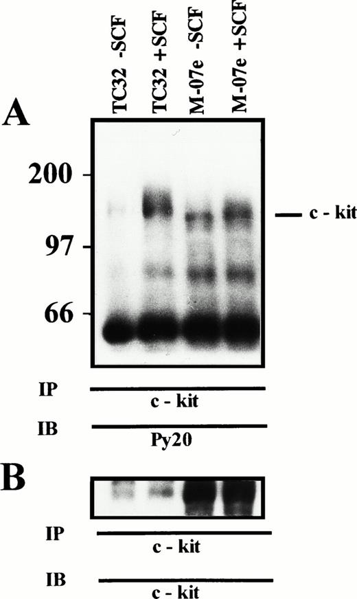 Fig. 5. (A) SCF-induced tyrosine phosphorylation of c-kit. TC32 (PNET) and M-07e (control) cells were incubated for 10 minutes with 0.5 μg/106 cells rhSCF, lysed, and immunoprecipitated with c-kit antiserum. Proteins were resolved by 7% SDS-PAGE, transferred to PDVF, and immunoblotted with antiphosphotyrosine antibody. Molecular mass of protein standards are indicated in kD. (TC32 − SCF), TC32 untreated cells; (TC32 + SCF), TC32 SCF treated cells; (M-07e − SCF), M-07e untreated cells; (M-07e + SCF), M-07e treated cells. (B) c-kit Immunoblot. The immunoblot from (A) was stripped and reprobed with an anti–c-kit MoAb.