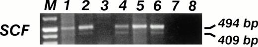 Fig. 6. SCF mRNA RT-PCR analysis. The specific 409- and 494-bp PCR fragments are visible in 5 out of 6 (83%) of sarcoma cell lines. Lane 1, 6647 (ES); lane 2, TC32 (PNET); lane 3, TC106 (ES); lane 4, PDN13 (PNET); lane 5, PDN12 (PNET); lane 6, PDE02 (ES); lane 7, B lymphoblastoid EBV-transformed cell line SCF mRNA neg; lane 8, No DNA.