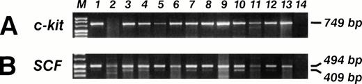 Fig. 7. SCF and c-kit mRNA RT-PCR analysis in 13 sarcoma's biopsies (lanes 1 through 13), and B lymphoblastoid EBV-transformed cell line SCF and c-kit mRNA neg (lane 14). (A) The specific c-kit 749-bp PCR fragment is visible in 12 out of 13 (92%) samples. (B) The SCF specific 409- and 494-bp PCR fragments are visible in 13 out of 13 (100%) samples.