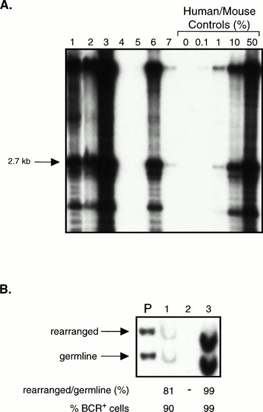Fig. 4. Transplantation of CD34+ cell-enriched chronic phase CML cells into NOD/SCID mice. (A) Southern blot showing the level of human cell engraftment in the BM of mice transplanted with 2 × 105 (lanes 4 and 5) or 2 × 106 (lanes 1 through 3 and 6 and 7) CD34+ cells (purity 63%) isolated from the PB of a patient with chronic phase CML. Mice were analyzed after 5 to 7 weeks except for mouse 3 and mouse 6 which were analyzed after only 2 to 3 weeks because of morbidity. DNA analysis was performed as described in Fig 1A. (B) BCR Southern analysis of the BM of mice 1 through 3 from (A). For methods, refer to Fig 3.