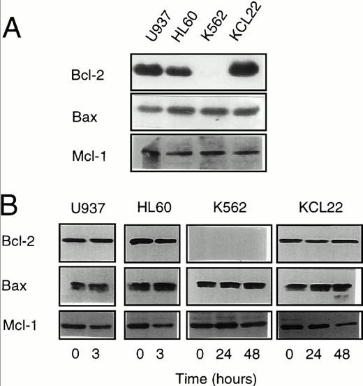 Fig. 2. Expression of Bcl-2, Bax, and Mcl-1 in untreated and etoposide-treated leukemic cell lines. (A) Western blot analysis of Bcl-2, Bax, and Mcl-1 basal expression in the four studied cell lines. (B) Western blot analysis of Bcl-2, Bax, and Mcl-1 expression in the four studied cell lines treated for indicated times with 100 μmol/L etoposide.
