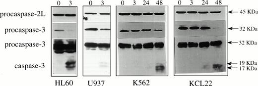 Fig. 4. Activation of procaspase-3 in etoposide-treated leukemic cells. Western blot analysis of procaspase-2L (the 45-kD long isoform of ICH-1), procaspase-3 (the 32 kD proenzyme CPP32/Yama/Apopain) and active caspase-3 fragments (p19 and p17) in cell lines treated for indicated times with 100 μmol/L etoposide.