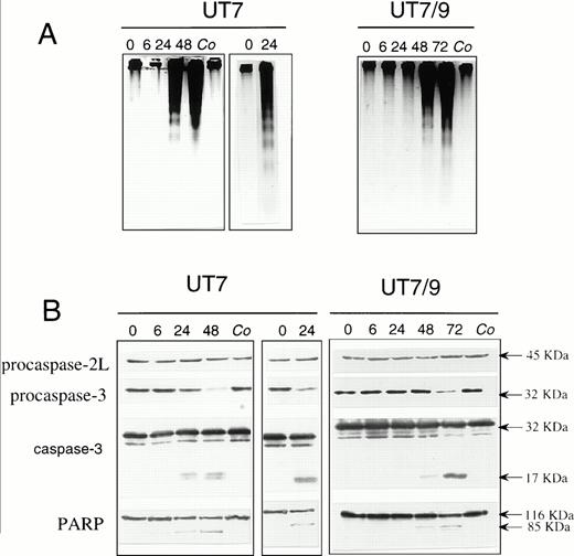 Fig. 5. p210bcr-abl expression delays apoptosis upstream of procaspase-3 activation and PARP cleavage. (A) Agarose gel electrophoresis of DNA from UT7 and UT7/9 cells treated for indicated times with 100 μmol/L etoposide (UT7, left panel; UT7/9: whole panel) or deprived from GM-CSF for indicated times (UT7, right panel). (B) Western blot analysis of procaspase-2L (the 45-kD long isoform of ICH-1), procaspase-3 (the 32-kD proenzyme CPP32/Yama/Apopain), active caspase-3 fragments and PARP in cell lines treated for indicated times with 100 μmol/L etoposide (UT7, left panel; UT7/9: whole panel) or deprived from GM-CSF for indicated times (UT7, right panel). (Co = control untreated cells = time 0.)