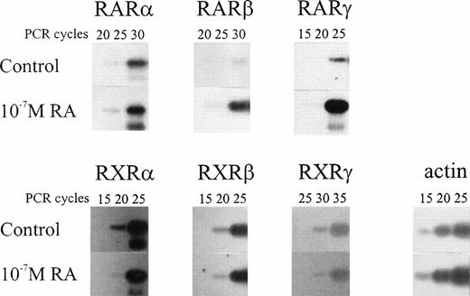 Fig. 3. Retinoid-receptor profile of RPMI 8226 cell line. Cells were treated or not for 7 hours with 10−7 mol/LatRA in defined medium. Total RNA (1 μg) was submitted to RT and PCR (for 15, 20, 25, 30, or 35 cycles), fractionated on 2% agarose gel, transferred to a Hybond N+ membrane, and hybridized to 32P-labeled oligonucleotidic probes for human RARα, RARβ, RARγ, RXRα, RXRβ, RXRγ, or β-actin. (For primers and probes see Materials and Methods).
