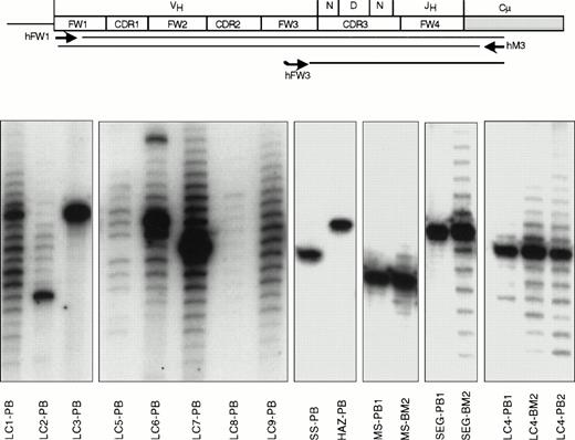 Fig. 1. Ig gene fingerprinting analysis of IgM-expressing B cells from 13 patients with HCV-associated immunocytoma. The μVH region transcripts were PCR amplified using a degenerate FW1 primer and a primer from the CH1 exon of the Cμ gene (scheme). To obtain better size fractionation and easier visualization of these fragments, radioactively labeled complementary copies of the CDR3/FW4 regions were synthesized by primer extension of a consensus 32P-labeled FW3 oligonucleotide. Autoradiograms obtained after the size separation of these fragments on sequencing polyacrylamide gel electrophoresis gels are shown in the lower part of the figure. Monoclonal B-cell populations contain a single band in the fingerprint (samples LC3-PB, SS-PB, HAZ-PB, MS-PB1, and SEG-PB1), representing the unique CDR3 length of their VHDJH rearrangement. Polyclonal B-cell populations show a ladder of bands, consistent with the different CDR3 lengths of their VHDJH rearrangements. Entirely polyclonal B-cell populations show a Gaussian distribution of the bands in the fingerprint (samples LC8-PB, LC9-PB). A band of stronger intensity, as seen in cases LC2-PB, LC6-PB, LC7-PB, MS-BM2, SEG-BM2, LC4-BM2, and LC4-PB2, indicates a monoclonal B-cell expansion within a polyclonal B-cell population. The source of the analyzed sample is indicated after each case. Samples in cases MS, SEG, and LC4 were collected at two different time points separated by more than one year (indicated as 1 and 2).
