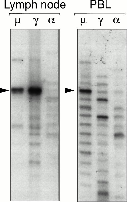 Fig. 2. Ig gene fingerprinting analysis of IgM (μ), IgG (γ), and IgA (α) heavy chain transcripts present in a neoplastic lymph node and a PB sample obtained from patient SEL. A dominant band corresponding to the lymphoma VH gene rearrangement can be seen in the fingerprint of the μ and γ transcripts from the lymph node. A prominent band of the same size is present in the fingerprint of μ transcripts expressed by PB lymphocytes. Sequencing reactions were used as markers to determine the exact sizes of the bands.
