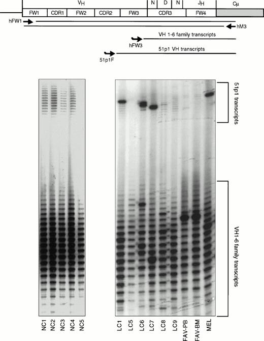 Fig. 5. Allele-specific Ig gene fingerprinting of IgM-expressing B cells. A schematic representation of the procedure is shown at the top of the figure. The positions of the PCR primers (hFW1 and hM3) and the primers used for labeling the PCR products (hFW3 and 51p1F) are indicated. The autoradiograms show the analysis of peripheral blood lymphocytes from five normal controls (NC1-5) and eight cases with HCV-associated immunocytoma (a BM sample from MEL was also analyzed). The locations of the bands corresponding to 51p1 transcripts and all VH transcripts are indicated. Expanded 51p1-expressing B-cell clones can clearly be seen in cases LC1, LC6, LC7, and MEL.