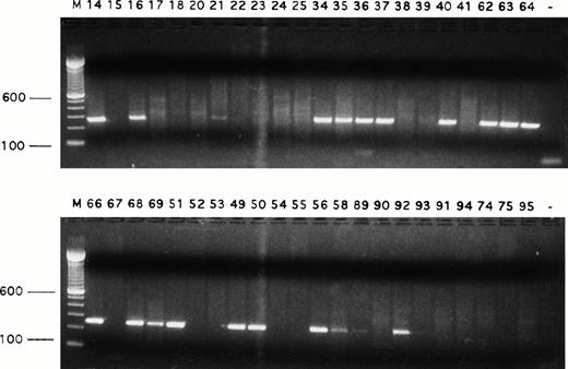 Fig. 2. Detection of Fas transcripts in single Reed-Sternberg cells and their variants. Fas transcript was expressed by many single Reed-Sternberg cells and their variants. PCR products were run on ethidium bromide-stained 1.5% agarose gels. Positive or negative results were scored on the basis of intensity of ethidium bromide staining. Sample numbers correspond to cell numbers listed in Table 1. Molecular-weight markers (M) are labeled in base pairs.