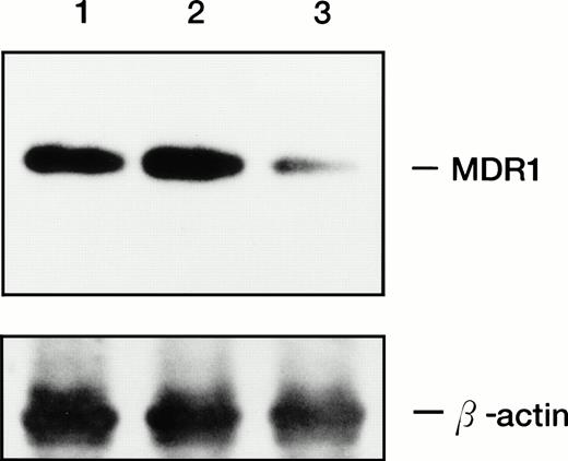 Fig. 4. Expression of MDR1 transcript in parental HL-60R, HL-60R/neo, and HL-60R/196Rz cells by RT-PCR analysis and subsequent Southern blotting. 196 MDR1 ribozyme was cloned into the expression vector, pHβAPr-1-neo and transfected into HL-60R cells by electroporation (HL-60R/196Rz). Control clone was derived by transfection of empty pHβAPr-1-neo alone (HL-60R/neo). A total of 1 μg of total RNA was reverse transcribed to cDNA and amplified by PCR with primers specific for MDR1 and β-actin as an internal control; the amplification products were electrophoresed, transferred, and hybridized with probes specific for MDR1 (upper bands) and β-actin (lower bands) genes. Lane 1, HL-60R cells; lane 2, HL-60R/neo; lane 3, HL-60R/196Rz cells.