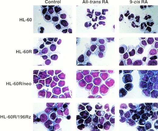 Fig. 6. Morphologic changes induced in wild-type HL-60, parental HL-60R, HL-60R/neo, and HL-60R/196Rz cells by either all-transRA or 9-cis RA. Cells were treated with 10−7mol/L of either retinoid for 4 days, and cytospin slides were then prepared and stained with Giemsa. Original magnification × 1,000.