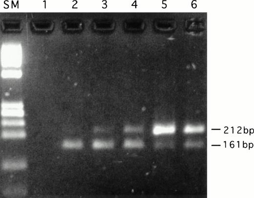 Fig. 4. Quantitative RT-PCR analysis of MDR1 mRNA. Reactions were performed as described in Materials and Methods. A representative experiment is shown. All reactions contained 100 ng total RNA. Internal standard (upper band) 212 bp, MDR1 mRNA (lower band) 161 bp. SM: Size marker (HaeIII digest ◊X174 DNA); 1: negative control (no RT); 2: 0.05 pg ISC RNA; 3: 0.25 pg ISC RNA; 4: 0.5 pg ISC RNA; 5: 1.0 pg ISC RNA; 6: 2.5 pg ISC RNA.