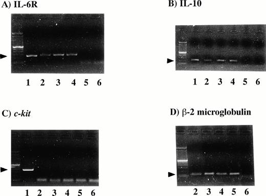 Fig. 1. Detection of IL-6R mRNA and IL-10 mRNA in the PEL cell lines. One microgram of RNA was used for cDNA synthesis. RT-PCR was performed for IL-6R, IL-10, c-kit and β-2 microglobulin. One fifth of the PCR mixture was analyzed by ethidium bromide staining of the 1.5% agarose gel (Lane 1, positive controls; lane 2, KS-1 cells; lane 3, BC-1 cells; lane 4, BC-2; lane 5, Jurkat cells, as a negative control; lane 6, water control). All three PEL cell lines were positive for IL-6R (A), 251-bp, IL-10 (B), 204-bp, and β-2 microglobulin (D), but negative for c-kit (C), 388-bp.