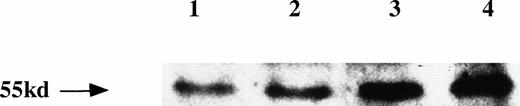 Fig. 2. Expression of IL-6R protein. Three PEL cell lines (lane 2, KS-1; lane 3, BC-1; lane 4, BC-2) expressed IL-6R protein (55 kD) by Western blot analysis. Myeloma cell line U266 (lane 1) was the positive control.