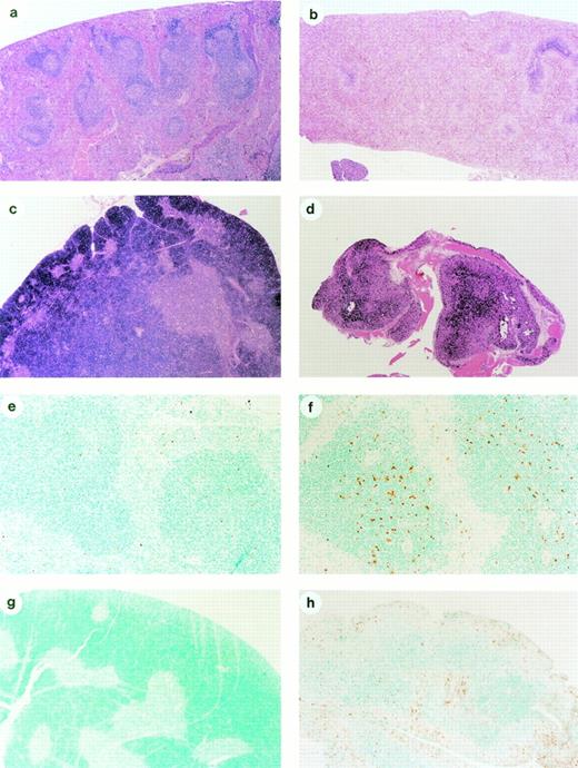 Fig. 1. Effect of flavopiridol on normal cells and tissues. (a) Histological section (10×) of the spleen of an untreated immunocompetent C57BL/6 mouse, showing a rich population of lymphocytes forming the germinal centers and marginal zone of the folliculi of the white pulp, surrounded by the blood-filled sinusoids of the red pulp. (b) Histological section (10×) of the spleen of an immunocompetent mouse 96 hours after initiation of treatment with daily IV bolus injection of flavopiridol, showing a marked depletion of lymphocytes, and only remnants of the white pulp. (c) Histological section of the thymus (10×) of a nontreated immunocompetent mouse showing the densely populated cortex by lymphocytes, surrounding the medullary areas of the lobules. (d) Histological section of a thymus (10×) of a flavopiridol-treated mouse showing an atrophic thymus, in which most lymphoid areas have disappeared. (e) ApopTag immunohistochemistry of the spleen (50×) of a nontreated mouse showing the rare presence of apoptotic brown-stained cells. (f) ApopTag immunohistochemistry of the spleen (50×) of a mouse 48 hours after initiation of treatment with flavopiridol, showing multiple brown-stained apoptotic lymphocytes in the follicular centers of the white pulp. (g) ApopTag immunostaining of the thymus (10×) of a nontreated immunocompetent mouse showing the lack of apoptosis in the lymphocyte-formed cortex. (h) ApopTag immunostaining of the thymus (10×) of a flavopiridol-treated mouse, showing a brown-stained, atrophic cortex caused by the death of thymocytes through apoptosis.