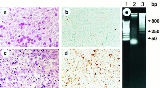 Fig. 2. Apoptotic death of human promyelocytic leukemia HL-60 cells in vivo after flavopiridol therapy. (a) Histological section of a s.c. HL-60 tumor (100×) removed from a nontreated control nude mouse, showing a large number of predominantly viable and dividing malignant blasts. (b) ApopTag immunostaining of the same HL-60 tumor as (a), showing the sporadic presence of brown-stained cells indicative of rare spontaneous apoptosis. (c) Histological section of an HL-60 tumor (100×) 96 hours after initiation of treatment with daily IV bolus injection of flavopiridol, showing multiple fragments of condensed chromatin (“apoptotic bodies”) indicative of cell death through apoptosis. (d) ApopTag immunostaining of an HL-60 tumor 96 hours after initiation of treatment with bolus IV flavopiridol. Multiple cells densely stained brown indicate DNA fragmentation. (e) Agarose gel analysis of DNA isolated from SUDHL-4 nontreated lymphoma (lane 2), and DNA isolated from a tumor 72 hours after initiation of treatment with flavopiridol (lane 3), which shows the typical “ladder” pattern of internucleosomal cleavage of DNA into multiples of 180 to 250 bp. Lane 1 includes DNA molecular mass markers.