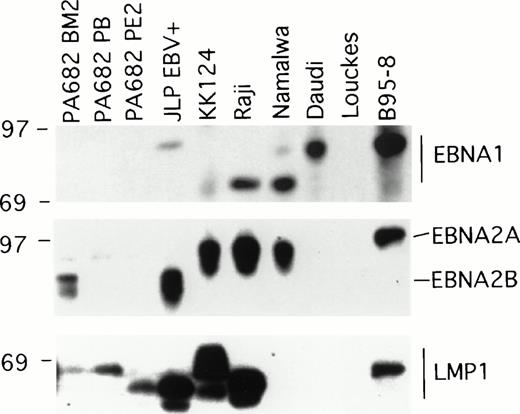 Fig. 1. Western blot analysis of EBV gene expression in BL cell lines. Cell extracts from 2 × 105 cell equivalents were electrophoresed through 8% Tris-glycine gels, transferred onto nylon membranes, probed with specific MoAb antibodies that recognize EBNA1 (AB-1), EBNA2 (PE2), and LMP1 (S12), and developed.