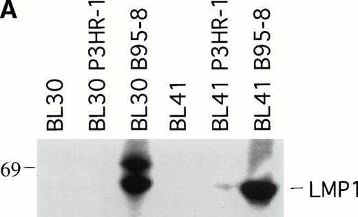 Fig. 2. LMP1 expression and tumorigenicity of BL30 and BL41 cell lines. (A) Western blot analysis of LMP1 expression in the BL30 and BL41 cell lines infected with P3HR-1 or B95-8 EBV. Cell extracts from 2 × 105 cell equivalents were electrophoresed through 8% Tris-glycine gels, transferred onto nylon membranes, and probed with a murine MoAb to LMP1 (S12). (B) Growth curves of tumors induced by subcutaneous inoculation of the EBV− and EBV-converted BL30 and BL41 cell lines. Each data point represents the mean tumor size of all mice in each group (5 to 10 mice per group). Mice injected with parental or P3HR1-converted cell lines were killed when the tumors had reached large sizes and impaired animal mobility. (○), Parental; (□), P3HR-1; (▵), B95-8.