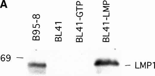 Fig. 3. LMP1 expression and tumorigenicity of LMP1-transfected BL41 cells. (A) Western blot analysis of LMP1 expression in parental, B95-8-EBV–converted, and LMP1-transfected BL41 cells. Cell extracts from 2 × 105 cell equivalents were electrophoresed through 8% Tris-glycine gels, transferred onto nylon membranes, and probed with a murine MoAb to LMP1 (S12). (B) Growth curves of tumors induced by subcutaneous inoculation of LMP1 or vector-transfected BL41 cells. Growth curves of tumors from vector-transfected BL41 cells and LMP1-transfected BL41 cells are depicted for individual mice.