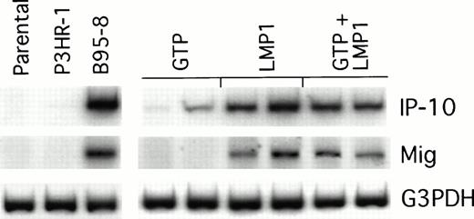 Fig. 5. Chemokine mRNA expression in LMP1-expressing and LMP1-nonexpressing Burkitt's tumors shown by semiquantitative RT-PCR analysis. Tumor tissue was obtained from Burkitt's tumors established in BALB/c nu/nu mice by subcutaneous inoculation of 107cells from LMP1-nonexpressing (parental BL41, P3HR-1–converted BL41, or GTP-transfected BL41) or LMP1-expressing BL cells (B95-8–converted BL41, LMP1-transfected BL41, or mixtures of GTP and LMP1-transfected BL41 cells). Tumors were obtained either when tumors were greater than 8 cm2 or when they developed typical tumor necrosis and scarring lesions that are indicative of tumor regression.