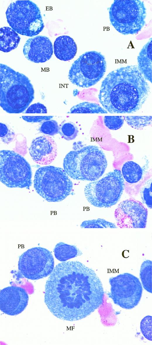 Fig. 1. Shown in panels A, B and C, are PB and immature (IMM) plasma cells. PB have fine reticular chromatin, scant cytoplasm (less than half the area of the nucleus), little or no hof, and either a large nucleus (>10 μm), or a large nucleolus (>2 μm). IMM plasma cells have the same nuclear features, but more abundant cytoplasm and usually a more prominent hof region.