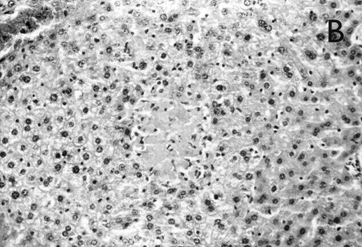 Fig. 3. (A) Micrograph of lung tissue 72 hours after intranasal infection with 1 × 103 CFU of K pneumoniae B5055. Lung abscess with severe tissue destruction in a PBS-treated control animal. Hematoxylin & Eosin (H&E); original magnification ×150. (B) Small foci of hepatic necrosis. H&E; original magnification ×600.