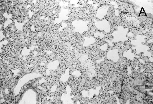 Fig. 4. (A) Micrograph of lung tissue 48 hours after intranasal infection with 1 × 103 CFU of K pneumoniae B5055 and pretreatment with G-CSF (50 μg/kg sc) at −48 hours, −36 hours, −24 hours, and −12 hours before infection. Peribronchiolar neutrophils without destruction of lung parenchyma. H&E; original magnification ×150. (B) Splenic abscesses in the red pulp containing numerous gram-negative bacilli are found. H&E; original magnification ×370. (C) Confluent hepatic necroses. H&E; original magnification ×150.