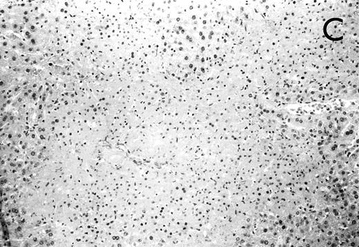 Fig. 4. (A) Micrograph of lung tissue 48 hours after intranasal infection with 1 × 103 CFU of K pneumoniae B5055 and pretreatment with G-CSF (50 μg/kg sc) at −48 hours, −36 hours, −24 hours, and −12 hours before infection. Peribronchiolar neutrophils without destruction of lung parenchyma. H&E; original magnification ×150. (B) Splenic abscesses in the red pulp containing numerous gram-negative bacilli are found. H&E; original magnification ×370. (C) Confluent hepatic necroses. H&E; original magnification ×150.