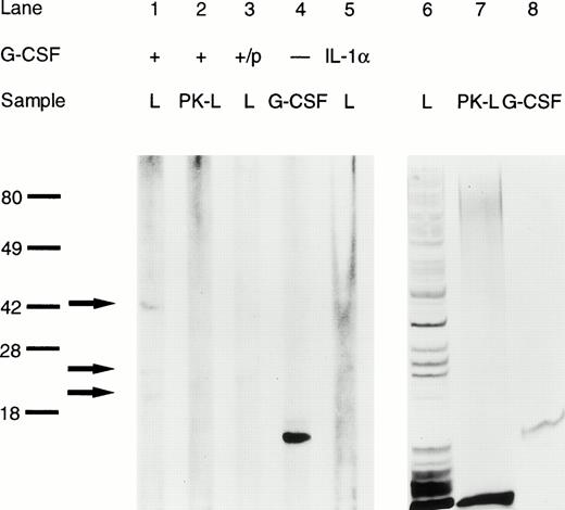 Fig. 8. Binding of G-CSF to K pneumoniae B5055 whole cell lysates as assessed by immunoblotting. L, bacterial cell lysate; PK-L, bacterial cell lysate pretreated with proteinase K; +/p, G-CSF preabsorbed with rabbit anti-human G-CSF-IgG. Lanes 1 through 5 are from a representative blot. Lanes 6 through 8 are from a silver-stained identical replica of the gel. Binding of G-CSF to specific bands is indicated by arrows; molecular weight (in kD) is indicated on the left.