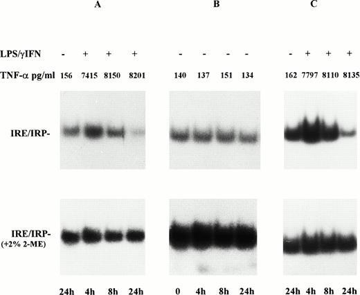 Fig. 1. Time course of IRP activity in monocytes and monocyte-derived macrophages from control subjects treated with LPs/IFN-γ. Monocytes from healthy blood donors were cultured in RPMI 1640 medium containing 20% autologous serum for 4, 8, and 24 hours in the presence (A) and absence (B) of cytokines (100 U/mL IFN-γ + 1 μg/mL LPS). Cells were also maintained in culture for 6 days to allow differentiation to macrophages and were then treated with cytokines for the same time periods (C). Cytoplasmic extracts (2 μg protein) were analyzed for IRE-binding activity by RNA-bandshift assay with excess32P-labeled IRE probe in the absence (upper panels) and presence (lower panels) of 2% 2-mercaptoethanol. TNF-α production was assayed in the culture medium by enzyme-linked immunoassay. After a transient increase, IRP activity returned to that of untreated cells and was eventually downregulated at 24 hours after stimulation with LPS/IFN-γ in both monocytes and monocyte-derived macrophages.