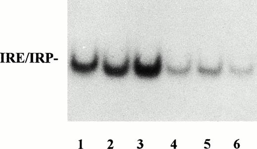 Fig. 4. IRP activity in monocytes from control subjects and patients with SH or inflammation. Lysates of monocytes from control subjects (lanes 1 through 3), patients with inflammation disorders (lanes 4 and 5), and patients with SH (lane 6) were assayed for IRP activity as described in Fig 1. IRP activity was lower in patients with inflammation than in control subjects and was comparable with that of patients with SH.