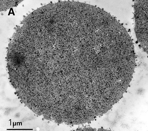Fig. 2. Characterization of rat exosome-bead conjugates by electron microscopy. Electron micrographs of magnetic beads immunologically coated with exosomes. Beads were coated with vesicles of 60 nm average diameter. Most vesicles were filled with electron-dense material (A) (bar, 1 μm). The beads were uniformly coated with vesicles, with most of them directly attached to the beads. Some vesicles appeared to be extracted and partially flattened (B).