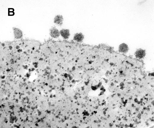 Fig. 2. Characterization of rat exosome-bead conjugates by electron microscopy. Electron micrographs of magnetic beads immunologically coated with exosomes. Beads were coated with vesicles of 60 nm average diameter. Most vesicles were filled with electron-dense material (A) (bar, 1 μm). The beads were uniformly coated with vesicles, with most of them directly attached to the beads. Some vesicles appeared to be extracted and partially flattened (B).