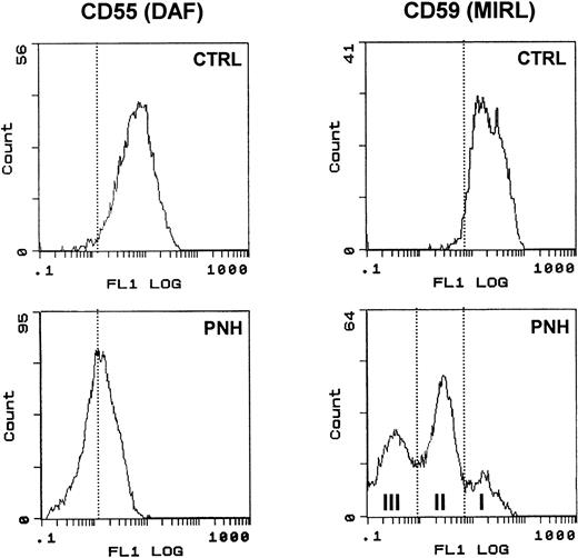 Fig. 5. Surface expression of DAF and MIRL on the surface of RBC. RBCs from a control subject (CTRL) and a patient (PNH) were analyzed for CD55 and CD59 expression as described in Materials and Methods. Note the typical heterogeneous pattern of CD59 staining obtained with PNH cells compared with the uniformly positive staining of control RBC.