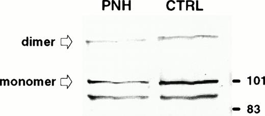 Fig. 6. Immunodetection of TfR in exosomes released from control and PNH reticulocytes. Samples (50 μg protein) were subjected to sodium dodecyl sulfate-polyacrylamide gel electrophoresis (SDS-PAGE) in a 10% acrylamide gel and proteins were transferred to nitrocellulose. TfR was detected by Western blot using a MoAb (OKT9) raised against human TfR and an alkaline phosphatase-conjugated rabbit antimouse antibody. The molecular mass (kD) standards are indicated on the right.