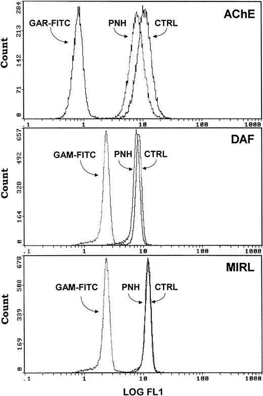 Fig. 7. Comparison of GPI-anchored protein (AChE, DAF, MIRL) expression onto control and PNH exosomes. Exosomes released from reticulocytes of a control subject (CTRL) and a patient (PNH) were analyzed, as described in Materials and Methods, for the presence of the different GPI-anchored proteins. Background staining obtained with only the FITC-labeled antibodies are presented.