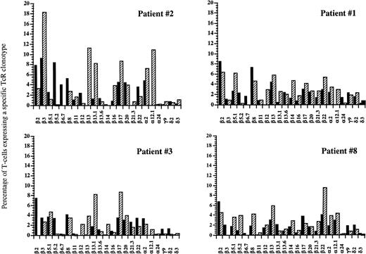 Fig. 8. FACS analysis of circulating V-TcR repertoire in four patients before and at 1 year after autologous HPC transplantation. Filled bars represent the percentage of peripheral CD3+ T lymphocytes expressing a given V-TcR before transplantation, and hatched bars represent the percentage expressing the same V-TcR at 1 year posttransplant.