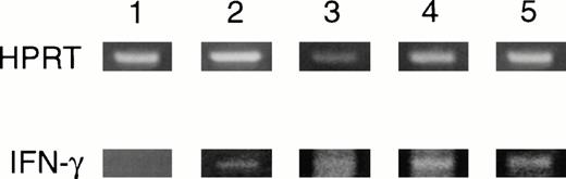 Fig. 9. BMT in chronic phase. Day 152 RT-PCR of spinal cord for IFN-γ. HPRT, housekeeping gene, hypoxanthine phosphoribosyl transferase. 1, naive; 2, control; 3, BMC; 4, TBI/BMT; 5, Cy/TBI/BMT.