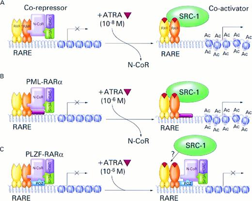 Fig. 6. Model for the role of nuclear receptor corepressor N-CoR/Sin3A/HDAC1 complex and RARα fusion proteins in the pathogenesis and treatment of APL. (A) In the absence of ATRA, RARα, PML-RARα, and PLZF-RARα associate with N-CoR/Sin3A/HDAC1 corepressor complex. The associated corepressor/RARα complex acts on chromatin structure by deacetylation of histone tails inducing its reorganization into a repressed state that is inaccessible to basal transcription factors. Binding of ATRA (orange triangle) induces conformational change in the RARα, causing dissociation of the corepressor complex and association of a coactivator, such as SRC-1, with intrinsic histone acetyltransferase activity.76Acetylation (Ac) of histone tails disrupts tightly packed and repressed chromatin structure, allowing access of the basal transcription factors and transcriptional activation. Physiologic concentrations of ATRA (10−8) are sufficient to induce this process. (B) In the case of the PML-RARα protein, pharmacologic doses of ATRA (10−6 mol/L) are required to achieve efficient dissociation of the N-CoR corepressor complex from the chimeric protein and transcriptional activation. (C) Because of additional, ligand-insensitive interactions between the PLZF moiety of the PLZF-RARα fusion protein and N-CoR (and possibly also Sin3A and HDAC1), the corepressor/PLZF-RARα complex remains associated even in the presence of pharmacologic concentrations of ATRA and, in the absence of chromatin remodelling by histone acetylation, transcription remains inhibited.