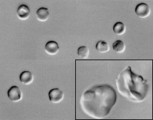 Fig. 3. Differential interference microscopy of in vitro-generated enucleated erythrocytes from CD34+ cells from normal human bone marrow cells. CD34+ cells were cultured under erythroid differentiation conditions and enucleated cells were FACS sorted as described in the Materials and Methods. Morphologically, the erythrocytes ranged from early polylobulated forms with a pinched or puckered membrane, resembling normal reticulocytes (enlarged in inset), to smooth biconcave discocytes.