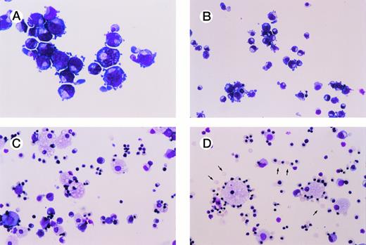 Fig. 1. In vitro erythropoiesis from normal human CD34+ progenitor cells. (A) through (D) show Wright-Giemsa–stained cytospins at serial time intervals of cultures initiated with purified normal human bone marrow CD34+cells. Culture conditions used to induce erythroid differentiation are described in the Materials and Methods. Enucleated RBCs are marked with arrows. All photographs were taken at original magnification × 200. (A) Day 7; (B) day 9; (C) day 12; (D) day 19.
