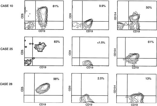 Fig. 2. Two-color immunofluorescence demonstrates B-cell expression of CD40L. (A) Unfractionated, peripheral blood cells from patients were analyzed by two-color immunofluorescence flow cytometry immediately after isolation. Shown are three examples including the best case (no. 10), an intermediate case (no. 25), and a low CD40L (CD154) case (no. 28). Each contour plot reflects expression of CD19 on the x-axis, demonstrated with a directly conjugated anti-CD19-FITC MoAb. The plots on the left demonstrate the results after exposure also to a PE-conjugated antibody to CD5, those in the center after exposure to a PE-conjugated antibody to CD3, and those on the right after exposure to a PE-conjugated antibody to CD40L (TRAP clone). The percentage of double-positive cells for each sample is indicated.