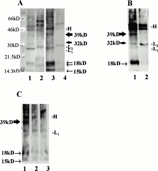 Fig. 5. Immunoprecipitation of CLL B-cell lysates with MoAb to CD40L. (A) CLL B cells were cultured with media alone (lanes 1 and 2) or IL-4 at 10 ng/mL (lanes 3 and 4) and, after 36 hours, cell surface proteins were biotinylated and lysates were prepared. For each circumstance, lysates from 6 × 106 cells were subjected to immunoprecipitation using MoAb to CD40L (TRAP clone, lanes 1 and 3) or MoAb to IL-4 (lanes 2 and 4). As shown, the precipitated monoclonal Ig heavy chain (46 kD, designated “H”) and light chains (∼29 kD, designated “L1” or “L2” for the κ chains of the antibody to CD40L and to IL-4, respectively) are evident in addition to the CD40L-specific bands. The 39- and 32-kD bands, corresponding to the two transmembrane forms of CD40L, are indicated with thick arrows, and the soluble forms of CD40L, which include a doublet at 18 kD and an additional, single band at 15 kD, are indicated with narrow arrows. (B) CLL B cells were stimulated for 60 hours in culture with IL-2 and SAC, after which cell surface proteins were biotinylated and lysates prepared. In this experiment, 210 μg of protein were used in each immunoprecipitation, either with MoAb to CD40L (lane 1, TRAP clone) or to IL-4 (lane 2). (C) Lysates from cultured, superantigen-reactive, CD4+ T cells derived from a CLL patient were used for immunoprecipitation of CD40L after biotinylation of cell surface proteins. Lane 1 shows a 39-kD band after lysates from 1 × 106 T cells were used for immunoprecipitation. In lanes 2 (5 × 105 T cells) and 3 (2.5 × 105 T cells), the band is not evident.