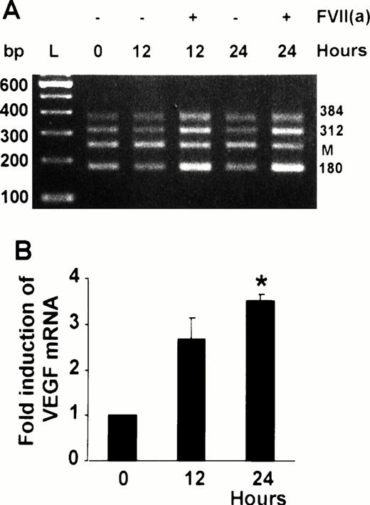 Fig. 4. VEGF mRNA induction by FVII(a). Confluent fibroblasts were incubated with or without 100 nmol/L FVII(a) for the times indicated. Five micrograms of total RNA was analyzed by RT-PCR. (A) Photograph from a representative experiment. Three VEGF mRNA transcripts are seen (180, 312, and 384 bp). The internal standard, mimic (M), is also visible. (B) RNA was quantified was achieved by scanning the Polaroid negative by laser densitometry. The density of the 180-bp band was normalized to the density of the mimic, and the fold induction of VEGF mRNA induced by FVII(a) compared with unstimulated cells at the same time was plotted. Each point represents the mean ± SEM of three experiments. *P < .01 versus unstimulated fibroblasts.