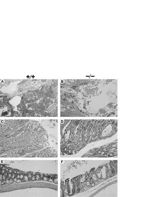 Fig. 4. Histological appearance of tissues from mice after acute exposure to MMC. Hematoxylin-eosin stained sections of mouse tissues (50%/50% C57Bl/6/129R1 genetic background) after acute exposure to 1.0 mg/kg MMC. (A and B) BM (×400); (C and D) glandular stomach (×200); (E and F) large intestine (×200). (A, C, and E) Fac+/+; (B, D, and F) Fac −/−.