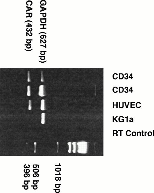 Fig. 8. CD34+ cells express CAR. RNA extracts from isolated human CD34+ cells were subjected to 35 cycles of RT-PCR reaction coamplifying CAR18 and GAPDH (see Materials and Methods). For comparison, RNA from HUVEC (positive control) and from the human leukemic cell line KG1a (negative control) were included in this experiment. RT control was performed with RNA from CD34+ cells that were treated with RNAse H before RT-PCR. Two different samples of peripheral blood CD34+ cells (lanes 1 and 2), as well as HUVEC (lane 4), demonstrated a strong signal of expected size (432 bp) for CAR. The presence of GAPDH (627 bp) in all samples demonstrates equal representation of mRNA from each sample.