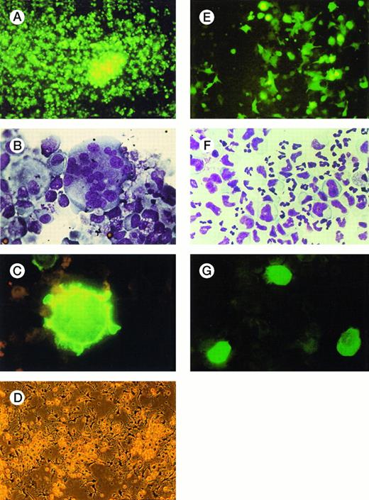 Fig. 7. Morphologic analysis of hematopoietic precursor cells several days after infection with AdGFP. Forty-eight to 96 hours after infection of expanded precursor cells with AdGFP, fluorescence and light microscopic analysis of liquid cultures and cytospin preparations were performed. (A) Megakaryocytic cells in liquid culture demonstrated bright fluorescence 48 hours after infection (100 MOI). (B) Cytospin preparations of the same culture confirmed the presence of large multilobulated and monolobulated megakaryocytes (Wright-Giemsa staining; original magnification ×1,000). (C) Examined under UV light, these cells were brightly fluorescing (×1,000). Cytoplasm pseudopods and blebs, typical features of polyploid mature megakaryocytes, are recognizable. (D) Liquid culture of dendritic cells shown in phase-contrast microscopy before infection. (E) The same cell culture 48 hours after infection with 100 MOI of AdGFP shows numerous dendritic cells expressing GFP (×100). (F) Cytospin preparations of myelomonocytic expansion cultures 72 hours after infection (100 MOI) show morphologically normal granulocytic and monocytic precursor cells (Wright/Giemsa staining, ×600). (G) Examined with UV microscopy, mainly large monoblastic cells expressed GFP.