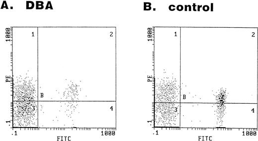 Fig. 5. Expression of the Fas antigen in erythroid lineage cells in bone marrow. Bone marrow cells obtained from a DBA patient (A) and a healthy volunteer (B) were stained with the FITC-conjugated anti-GPA and PE-conjugated anti-Fas antibodies. The panel shows the fluorescence intensity of GPA (x-axis) and Fas (y-axis).