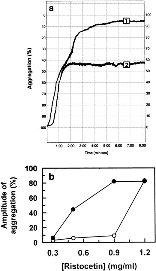 Fig. 2. Ristocetin-induced patient platelet aggregation. (A) Aggregation of patient's PRP by 0.5 mg/mL ristocetin before (1) and after daily intake of 1,000 mg aspirin for 7 weeks (2). (B) Intensity of aggregation response as a function of ristocetin concentration during aggregation of normal (○) and patient (•) PRP, 7 weeks after daily intake of 1,000 mg aspirin.