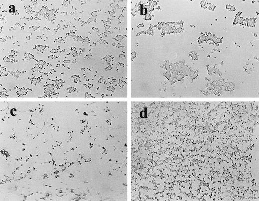 Fig. 7. Platelet adhesion during perfusion over collagen and vWF. Platelet adherence after perfusion for 2 minutes of anticoagulated normal blood through glass capillaries coated with collagen (a, b) or vWF (c, d), in the absence (a, c) or presence of 5% (b) or 10% (d) patient plasma.